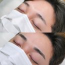 용인 역북동 눈썹 용인 위드민 추천 솔직후기