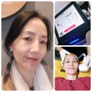 일산 피부과 올타이트 400샷 추천후기 5세대 착붙 리프팅 통증 다운타임 가격