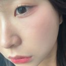 X(엑스)맨 당구장 | 강남피부과 모공주사 ESC60 엑소좀 젤리부스터 실펌엑스 시술 후기