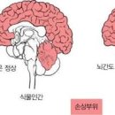 뇌사상태 뇌사판정 기준 그리고 식물인간 차이는 무엇일까 이미지