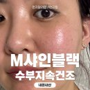 강남 피부과 추천 줄기세포피부주사 내돈내산 후기