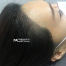 헤어부티
