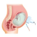 성복한의원 이미지