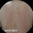 다니스킨