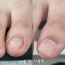 주디스네일