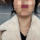 브이투 이경외과의원 | 💭 30대, 얼굴 살은 빠지는데 탄력은? 브이로리프팅! (+ 울쎄라, 온다리프팅 차이, 부작용 포함)