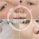 오민피부관리룸 | 경산 피부맛집 mts피부관리 뷰티블룸 경산점 솔직한후기