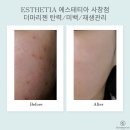 에스테티아사창