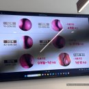 코숨온누리한의원 | 지방에서 강남까지! 병원 돌고 돌아 온 서울비염잘하는병원 추천, 라경찬한의원 만성 비염치료 후기