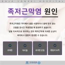 지속적으로 발바닥통증 느껴지면 사우동정형외과에서 치료해요 이미지