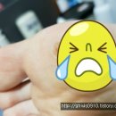 보람메트로피부과의원 티스토리