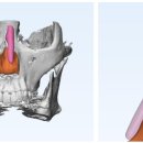 아베크 성형외과의원 이미지