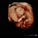 11650-16-173-2 | [임신일기#6] 16주 3일차 아기 초음파 신경관결손검사 A형간염 접종 조리원 예약 W여성병원