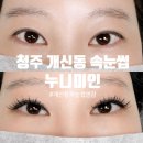 누니미인