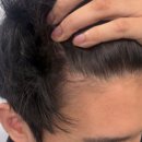 모디헤어플란트의원 이미지