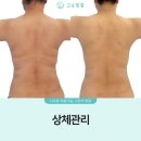 고운힐링팜 | 고운빛깔에스테틱대구점 대구피부관리 후기, 3D관리로 또렷해진 얼굴라인