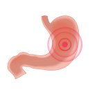 양평다나암병원 | [양평/양평군 요양병원/브니엘 노인전문병원] [소화기계 질환] 위암