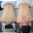 안산 고잔동 더 맑은 에스테틱에서 에너지 테라 등관리 체형교정 후기