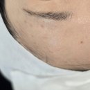 약초 | 천안여드름피부 관리 이정희스킨케어 약초필링후기