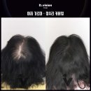 디비전 스칼프 이미지