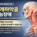 MFR 이야기 두개하악골 기능장애 (Craniomandibular Dysfunction, CMD) 이미지