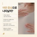 조이플성형외과의원 이미지