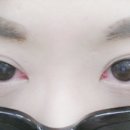 칠곡대구안과의원 이미지