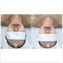 동안라인스킨케어 이미지