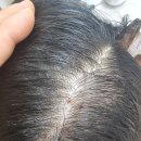 두피에 봄이 오다! '봄이오다 헤어토닉' 사용 후기, 진짜 효과 있을까?