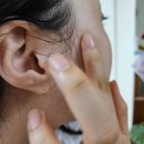 주식회사 바른메디 | 대학생 딸 피부톤이 달라졌다! 2주 꾸준히 바른 히루스카 후기