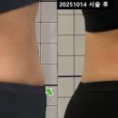 아크로한의원 이미지