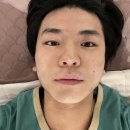[강릉 리타임 뷰티] 강릉 피부관리샵 / 포남동 피부관리샵 / 여드름 압출 / 내돈 내산 후기