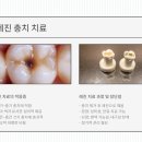 청아치과기공소 이미지