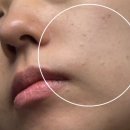 유어스 | 검단피부관리 유어스킨웰 시그니처 케어 후기 (피지압출 통증 솔직후기)