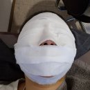 바른침한의원 | 노원역 피부과 추천 한의원 스피큘 필링 미세침 4회차 후기