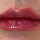 뷰티바성형외과의원 이미지