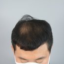 스칼프디자인센터 이미지