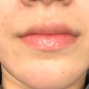 휴킨스피부과의원 이미지