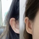 서울퀸성형외과의원 이미지