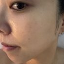 삼성사 | 문현동에스테틱 추천 글로우림 피부관리 받은 후기