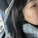 솔미한의원 | 수원여드름병원추천 여드름흉터한의원 어릴때부터 고통이었던 여드름, 모낭염치료 이젠 걱정없다 내돈내산