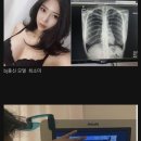 가슴 성형 의혹에 엑스레이 공개한 유명인들..jpg 이미지