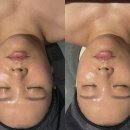 신신에스테틱;요가;명상 | 침산동 피부관리 신신에스테틱 홍조관리 리얼 후기