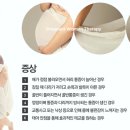 건강한테라피