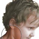 유아 사경(Torticollis) 치료법 이미지