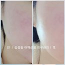 어펙션룸