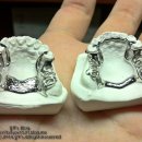 가온치과기공소 이미지