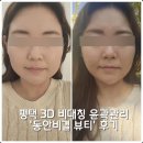 (주)세아메디칼 | 평택 비대칭 윤곽관리 체형교정 &#39;동안비결뷰티&#39; 후기