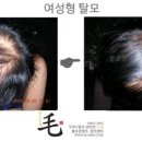 불로장생모