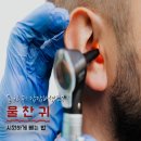 이명헤어 | 귀에 물 뺐던 7가지 방법, 솔직 후기
